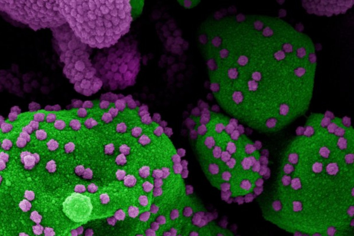  Estudo sobre vacina universal contra o coronavírus reforça esperança de cientistas
