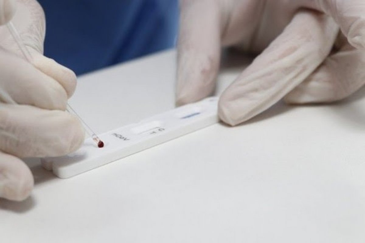 Veja os últimos dados da pandemia nesta quinta-feira (24)