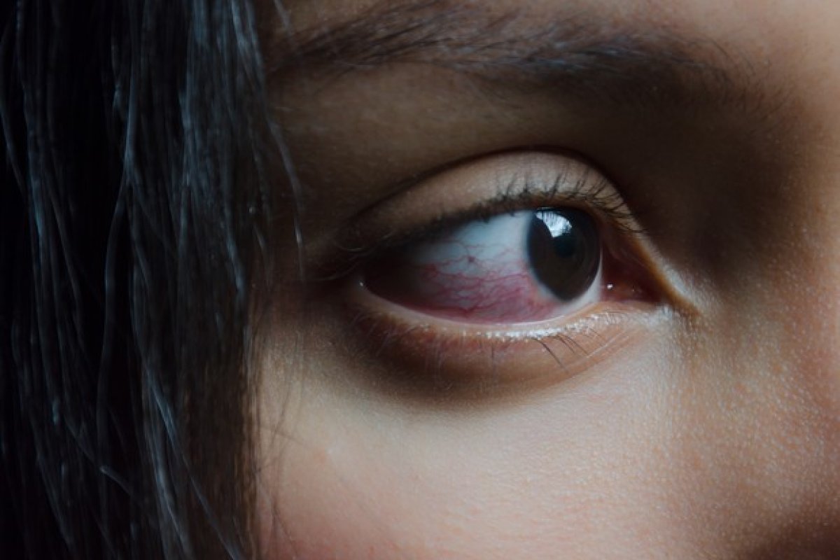 Pesquisa revela presença da proteína da covid-19 em tecidos oculares de pacientes infectados