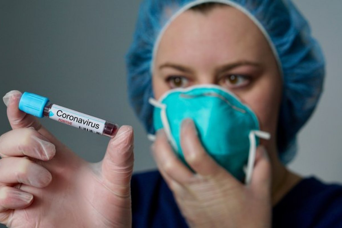 Pesquisa detecta anticorpos da Covid-19 em pacientes depois de 7 meses 