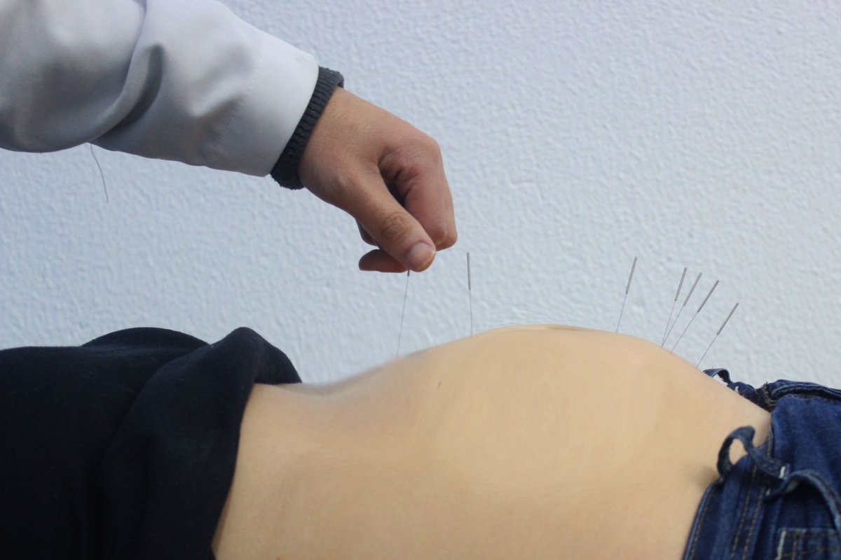 Acupuntura na gravidez
