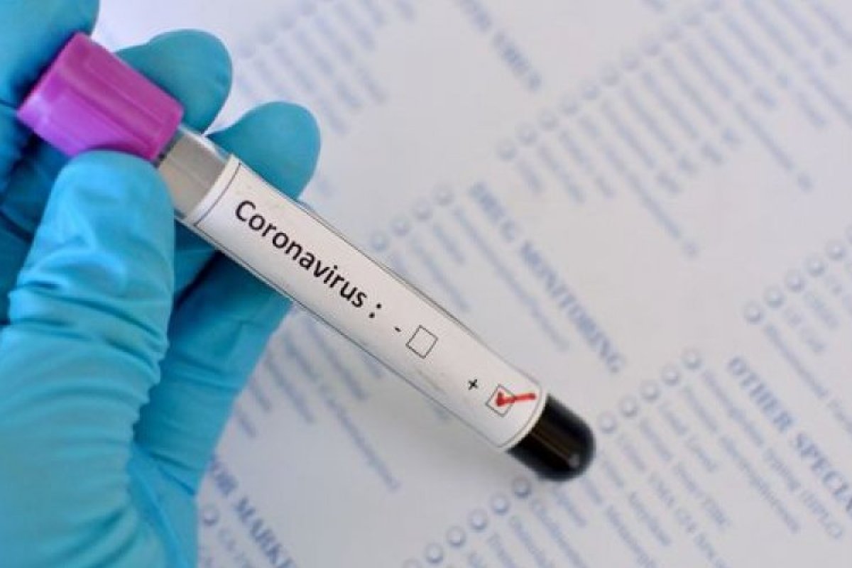 Covid-19: Bahia registra 457 novos casos nas últimas 24h