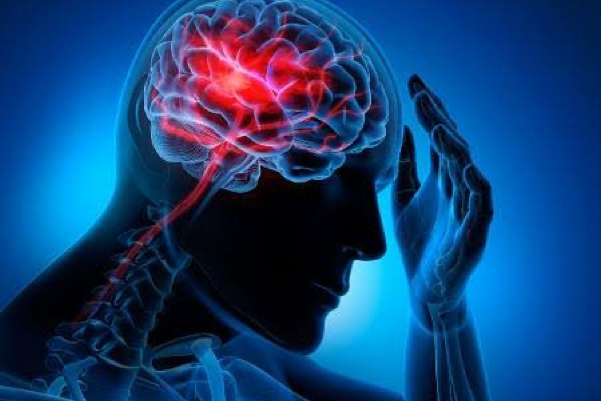 Neurologista explica os principais fatores de risco e como evitar o AVC que  levou Tom Veiga a óbito