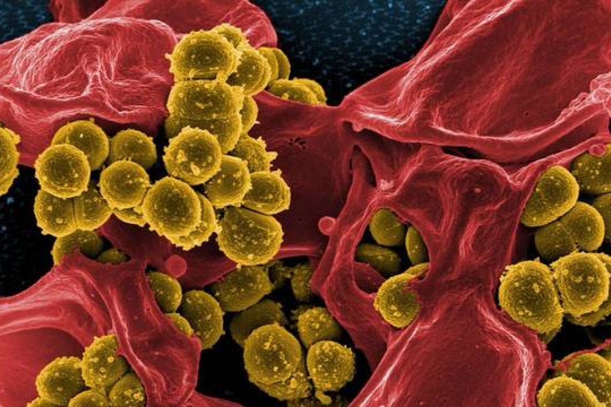 Segundo pesquisa, diabetes descontrolado é promissor para superbactéria