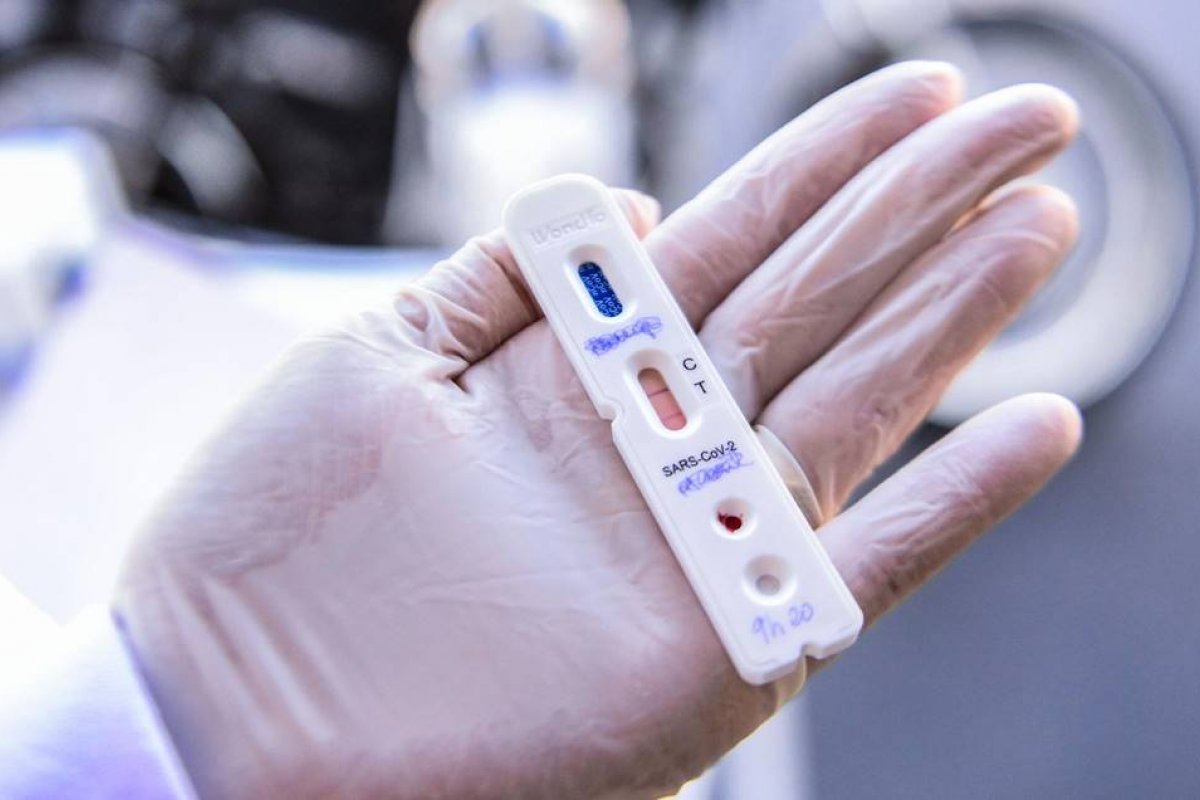 Faixa etária dos 29 aos 33 anos lidera resultados positivos para Covid-19 desde outubro