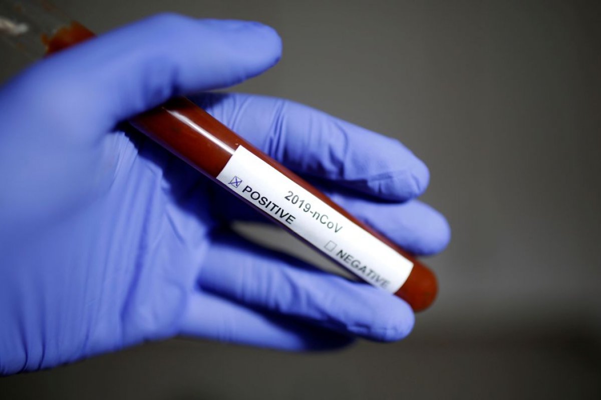 Ministério da Saúde confirma segundo caso de reinfecção pela covid-19