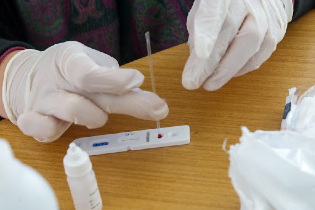 Dispara a busca de brasileiros por testes rápidos em farmácias