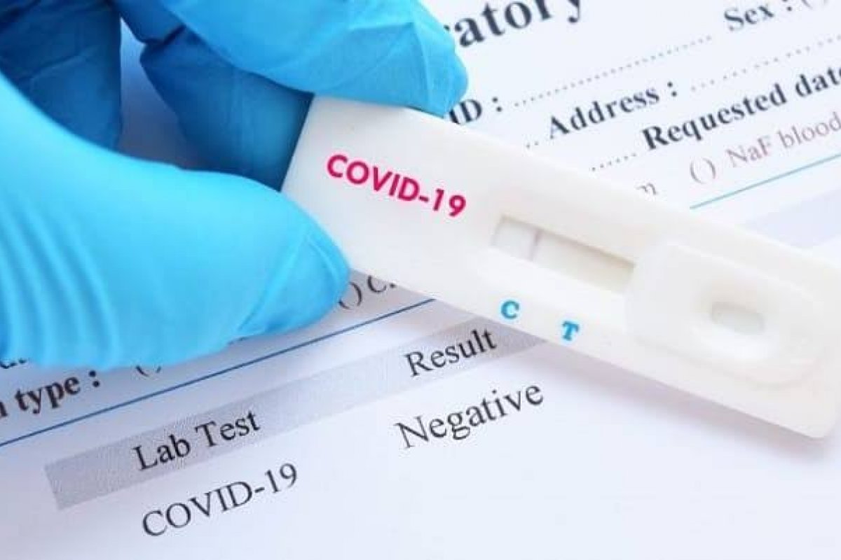 A importância dos testes para reduzir a proliferação do coronavírus