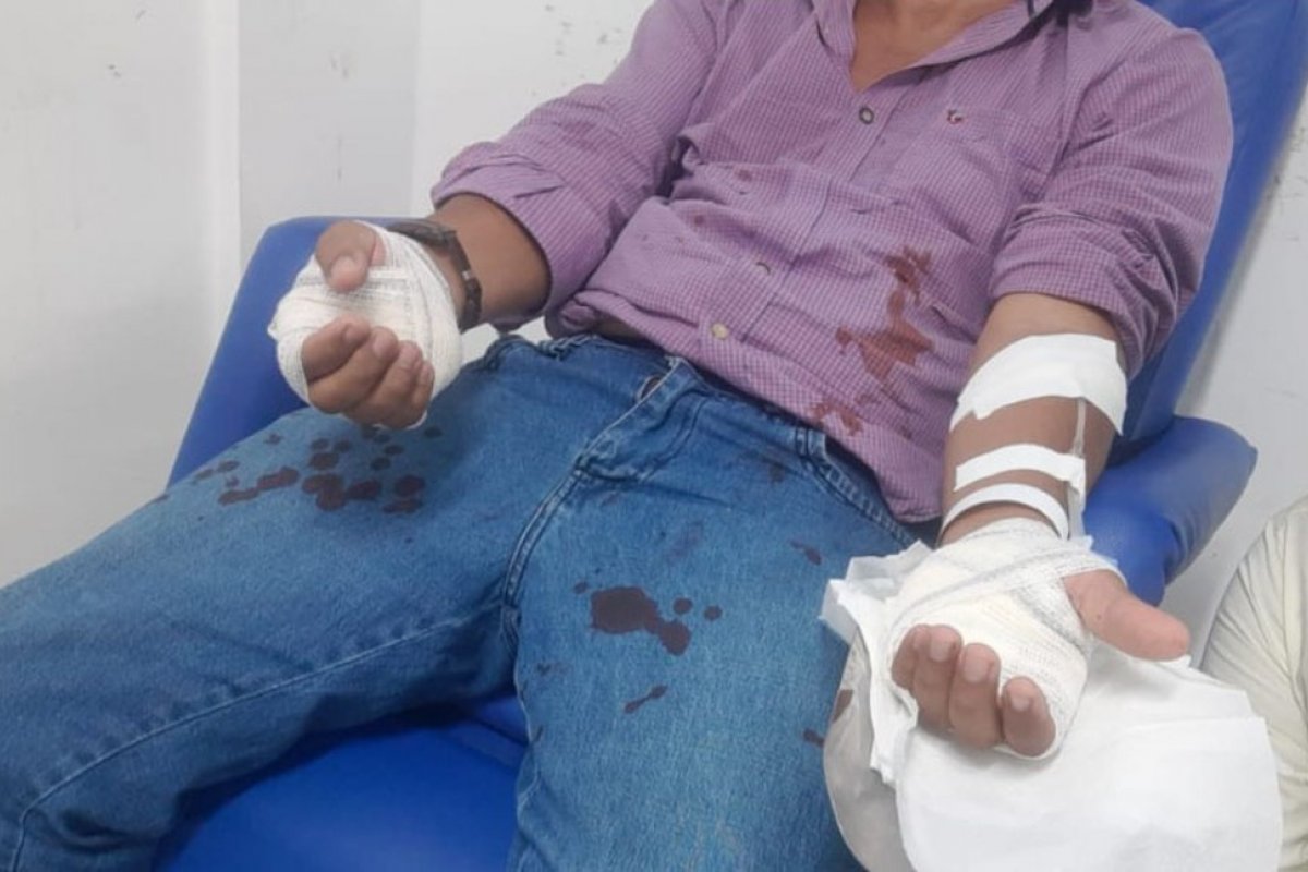 Taxista é esfaqueado em assalto na região dos Mares, em Salvador 