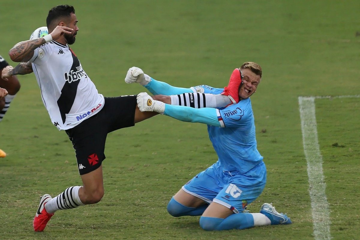 Veja como ficou o rosto do goleiro Douglas depois de ser atingido por chute de Castán