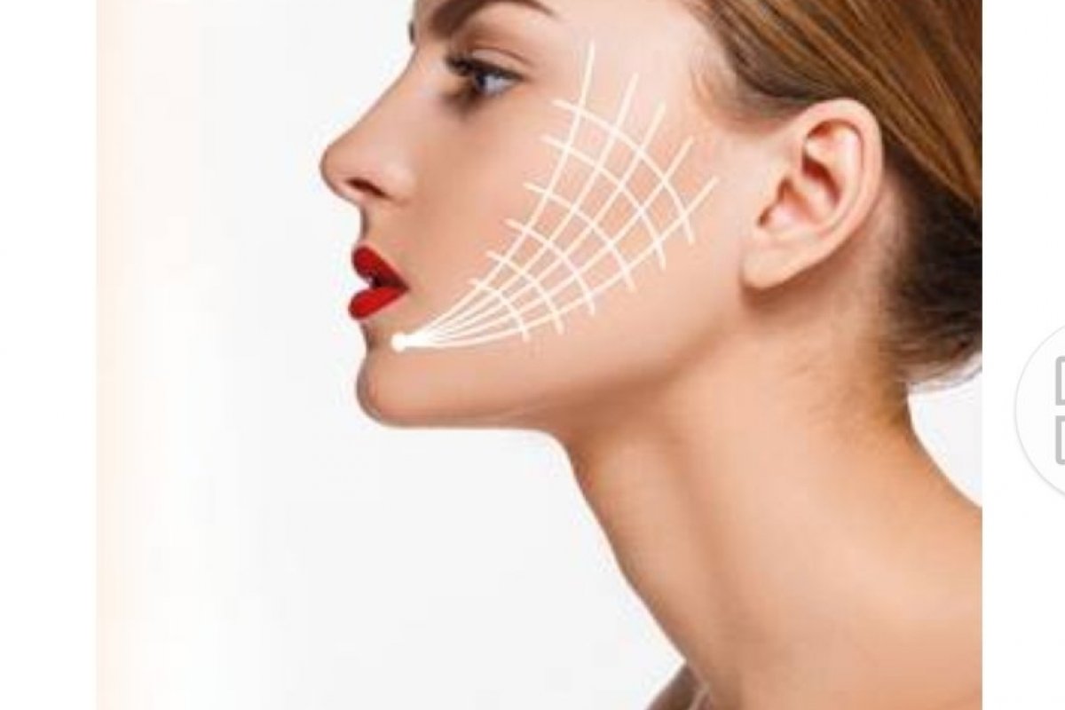 Conheça a técnica MD Codes™ para rejuvenescimento e harmonia facial