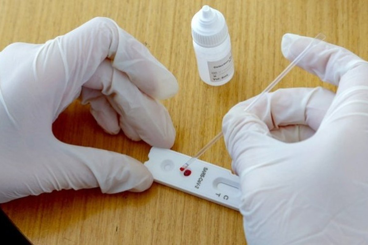 Prefeitura realiza testes que detectam em um dia 116 pessoas com Covid-19 em três bairros de Salvador 