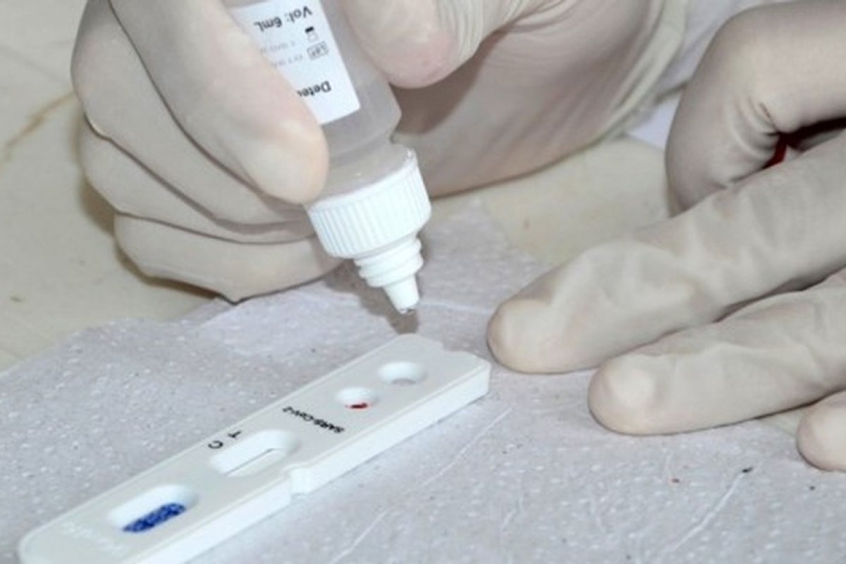 Testes rápidos identificam 202 casos de coronavírus em seis bairros 