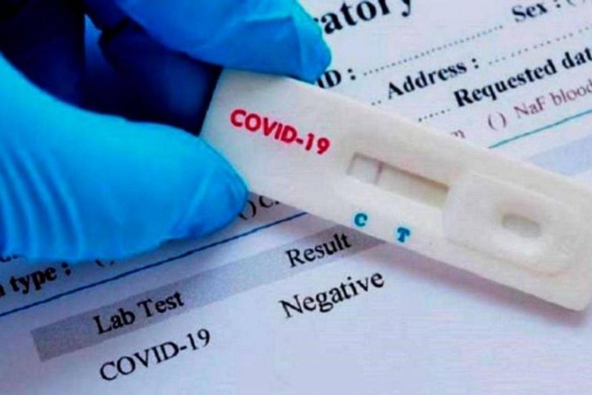 Farmácias registram recorde de 24% de casos de covid, diz Abrafarma