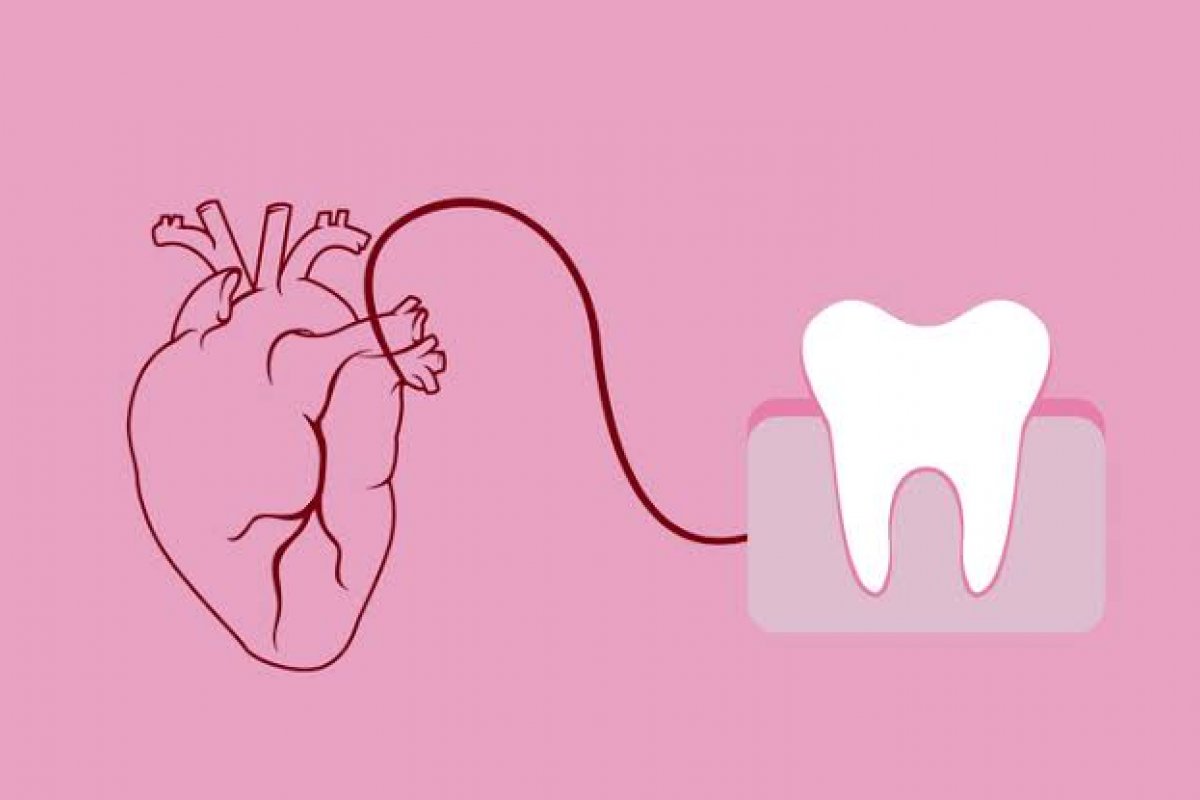 Cuidar dos dentes pode evitar doenças cardíacas!