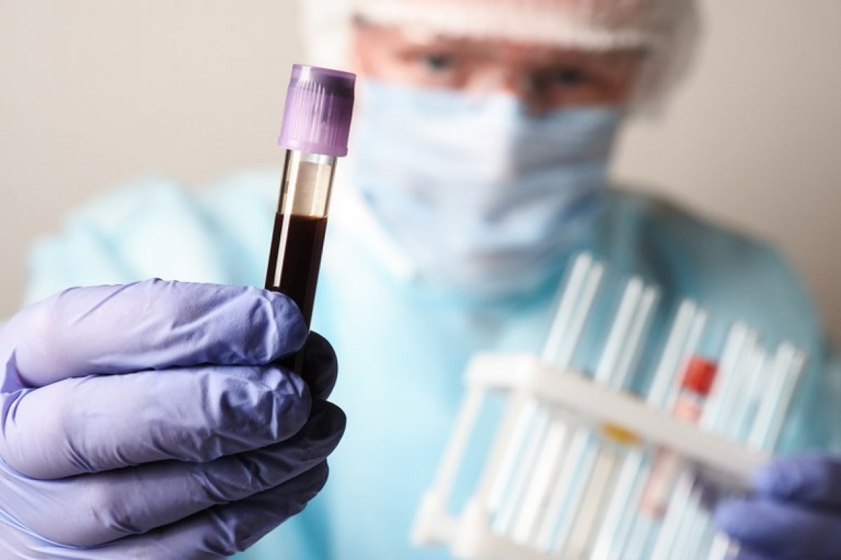 Estudo brasileiro afirma que reinfecção por Covid-19 pode ser mais agressiva mesmo sem variantes