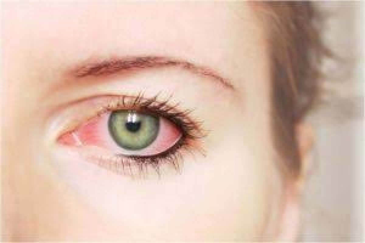 Glaucoma é principal causa de cegueira no mundo