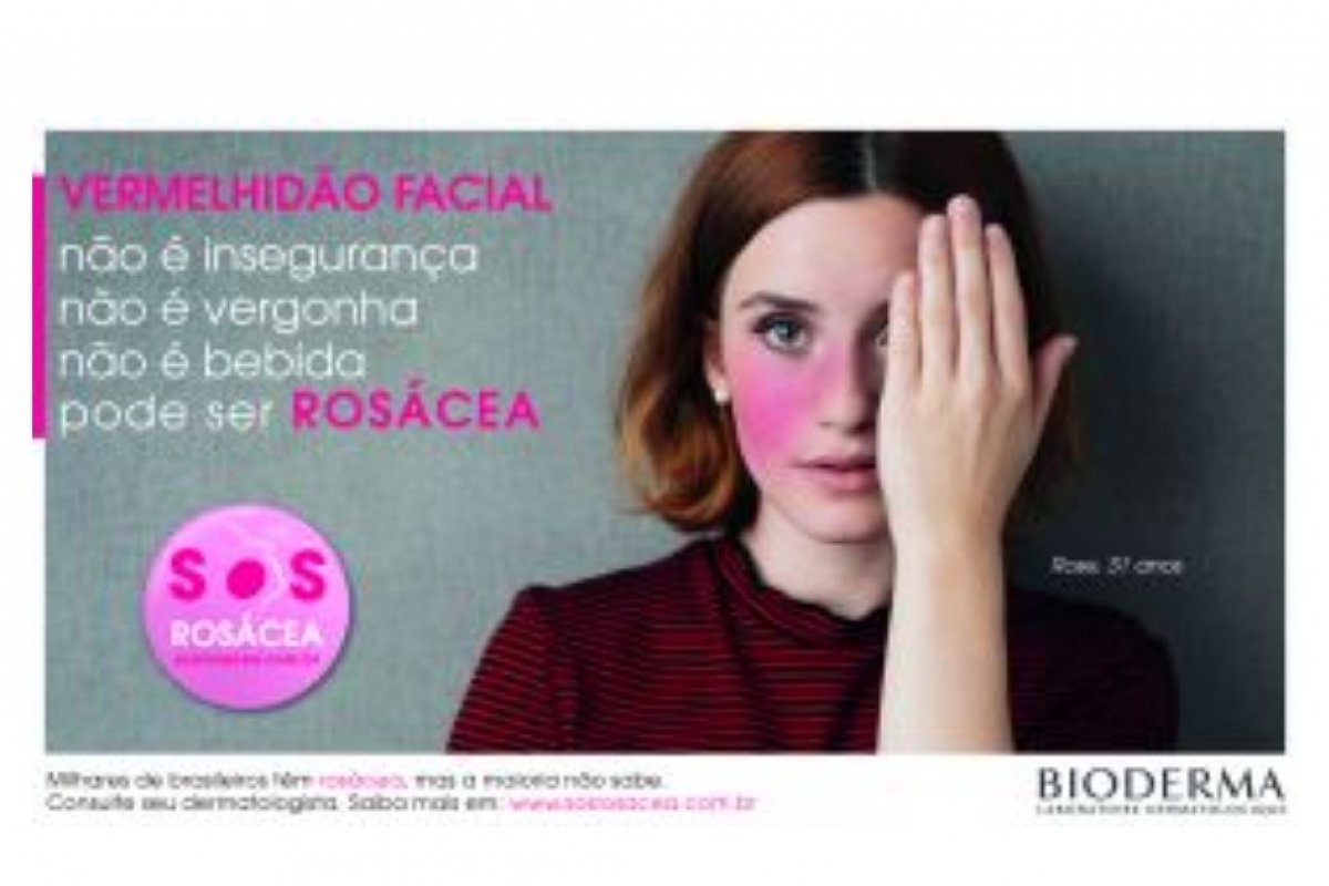 Você sabe o que é rosácea?