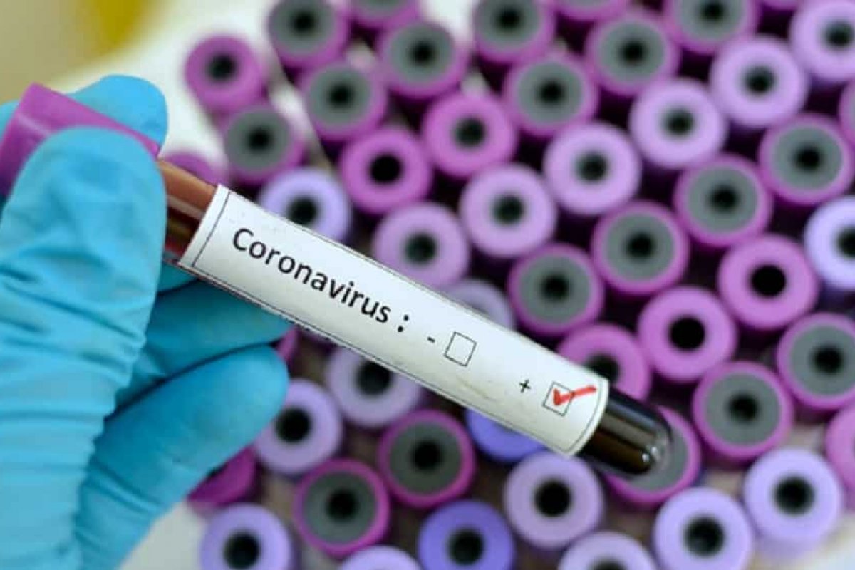 Brasil atinge marca de 14 milhões de infectados pela covid-19