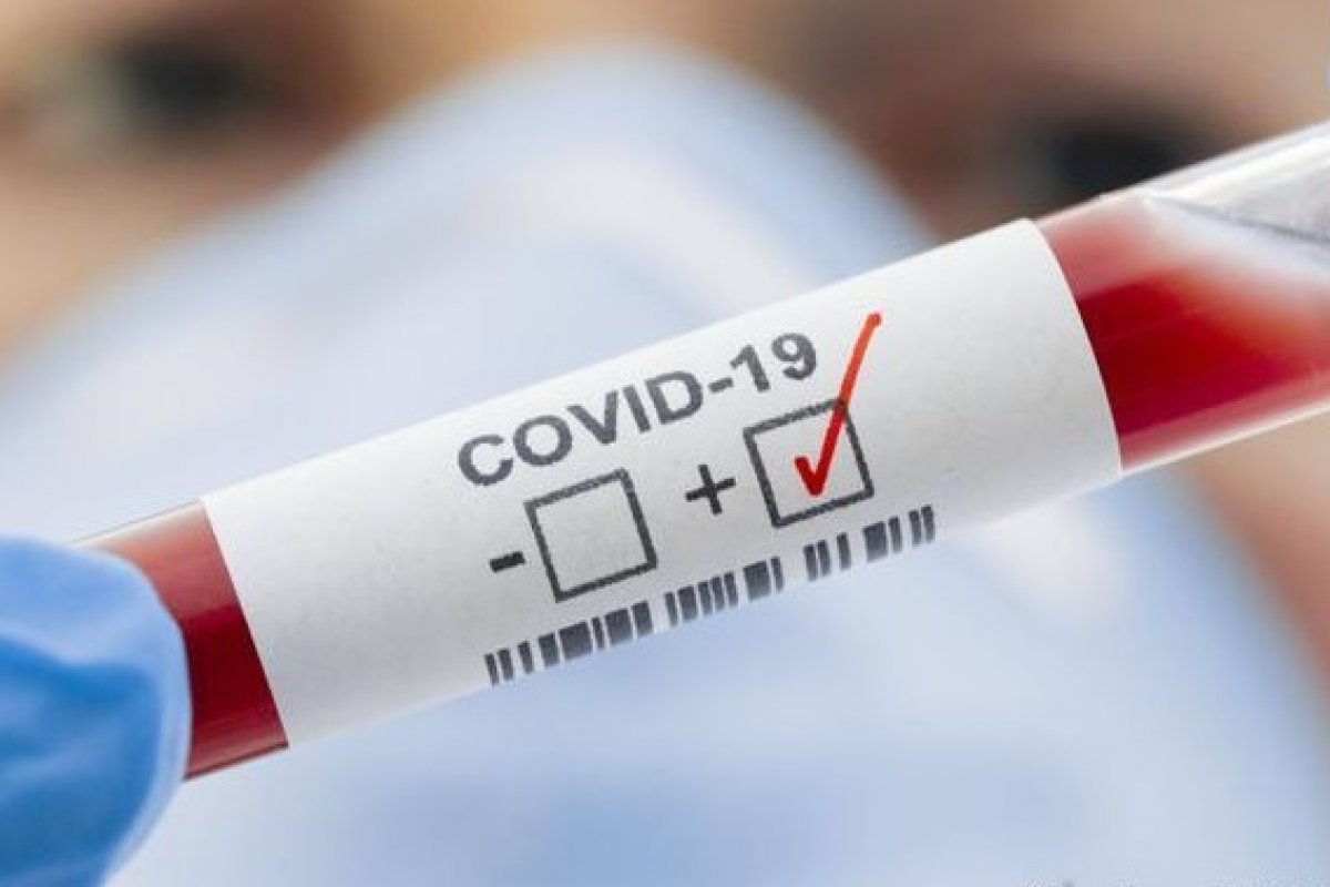 Covid-19: Brasil confirma mais 25 mil novos casos em 24h