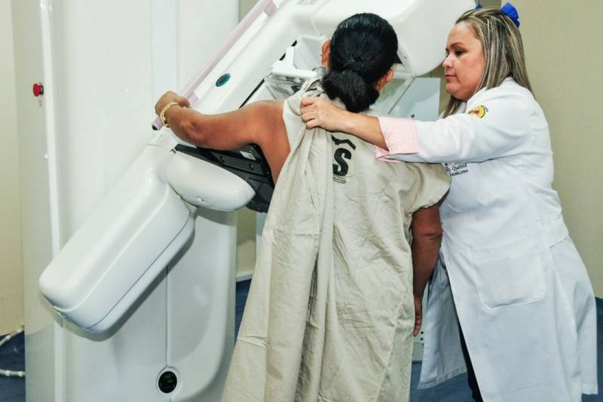 Brasil despenca ao menor nível em 10 anos no número de mamografias