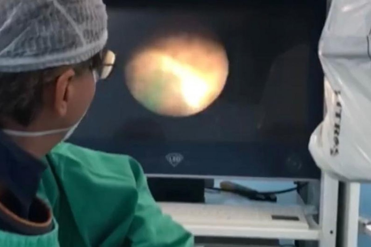 Martagão realiza primeira cirurgia de cálculo renal por laser do hospital
