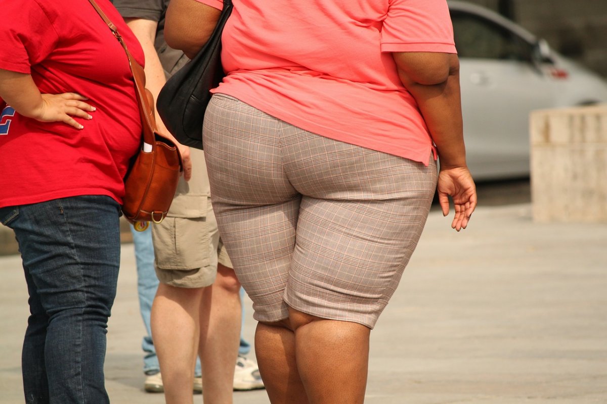 Genética aumenta risco de obesidade nas mulheres