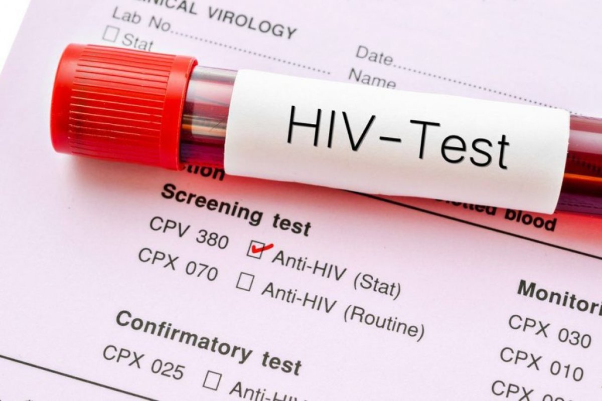 Altas doses de anticorpo intravenoso pode proteger humanos do HIV, diz pesquisa