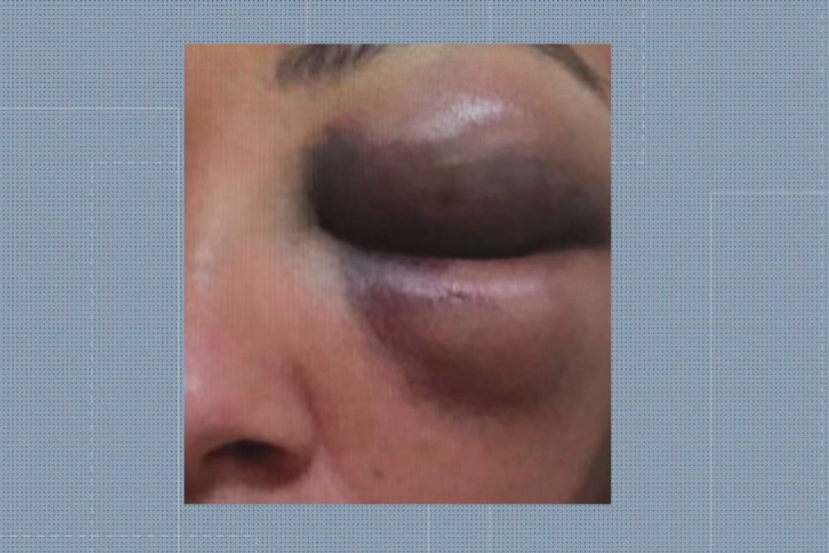 Preso lutador de artes marciais por suspeita de agredir ex-namorada