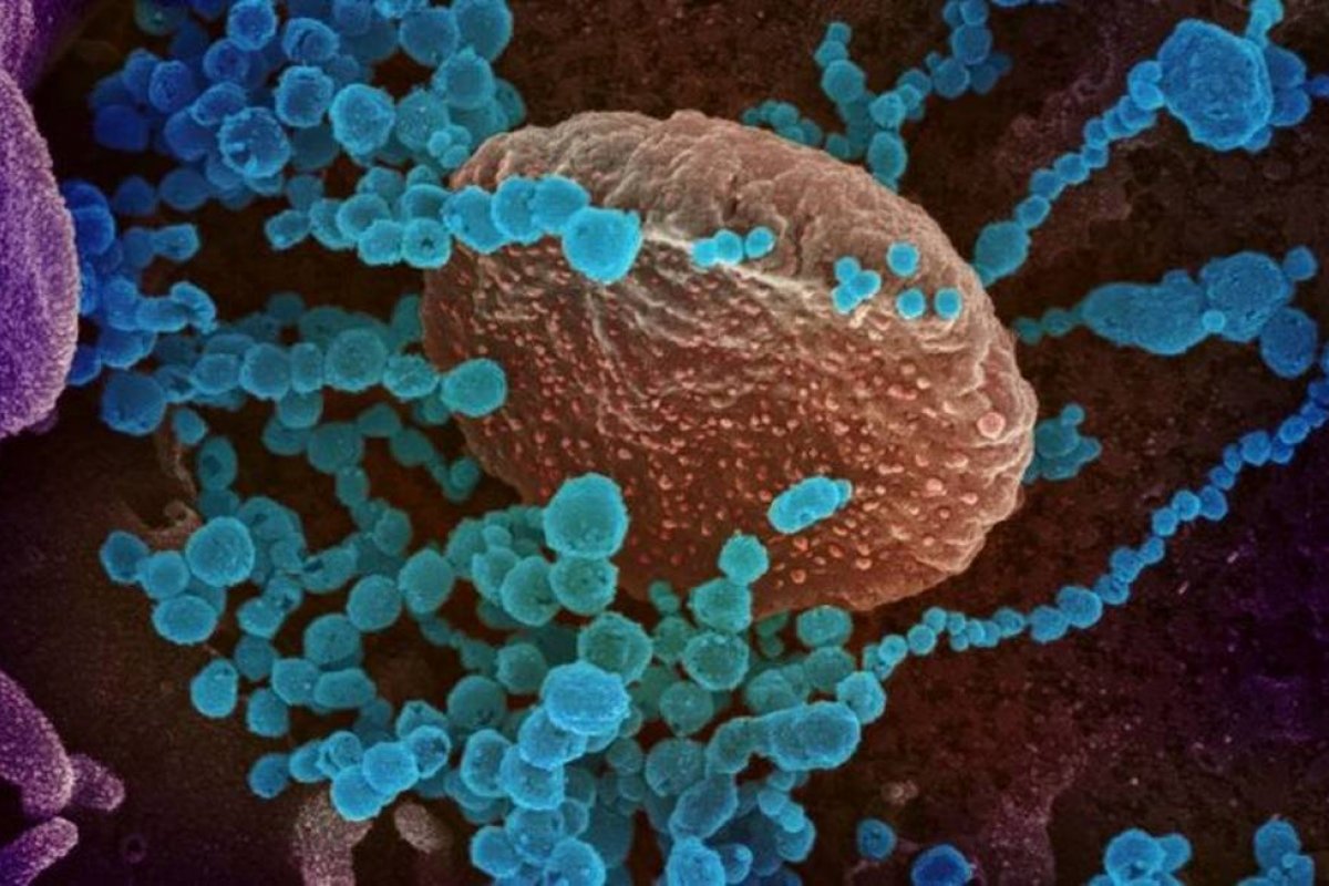 Cientistas criam teste rápido de saliva para identificar variantes da Covid-19