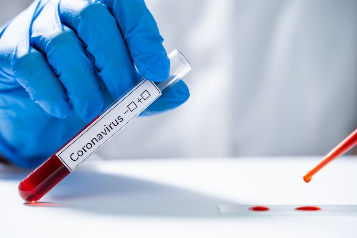 Ações de combate à Covid-19 custam R$ 298 milhões por dia ao Brasil