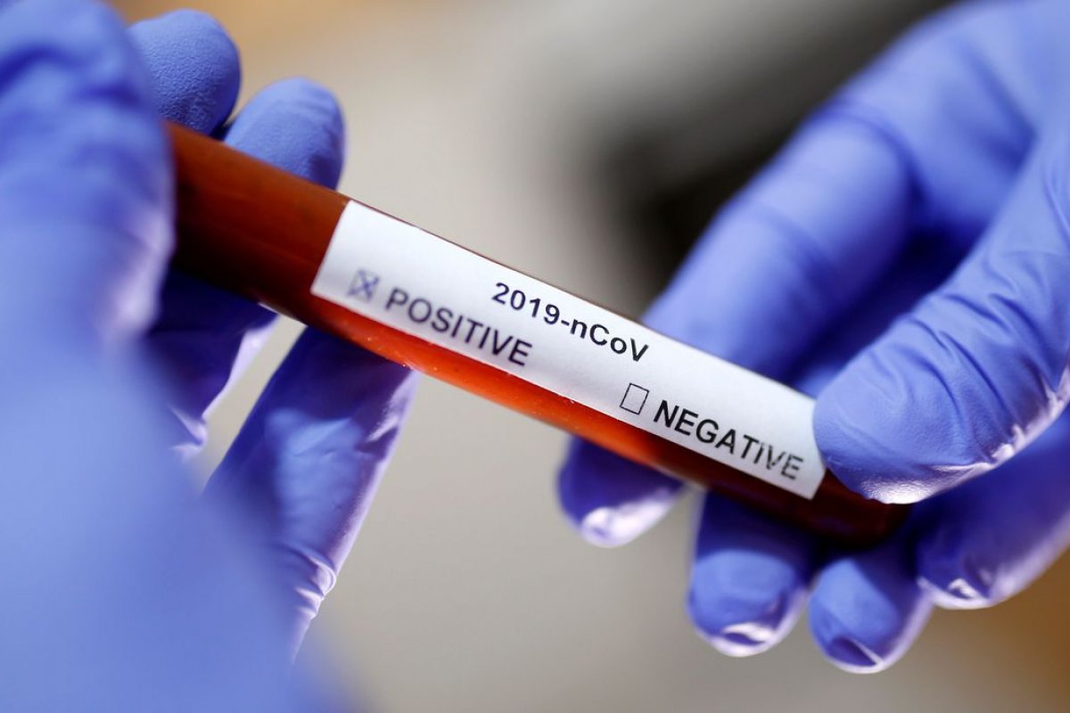 Brasil registra 321 novas mortes por Covid-19