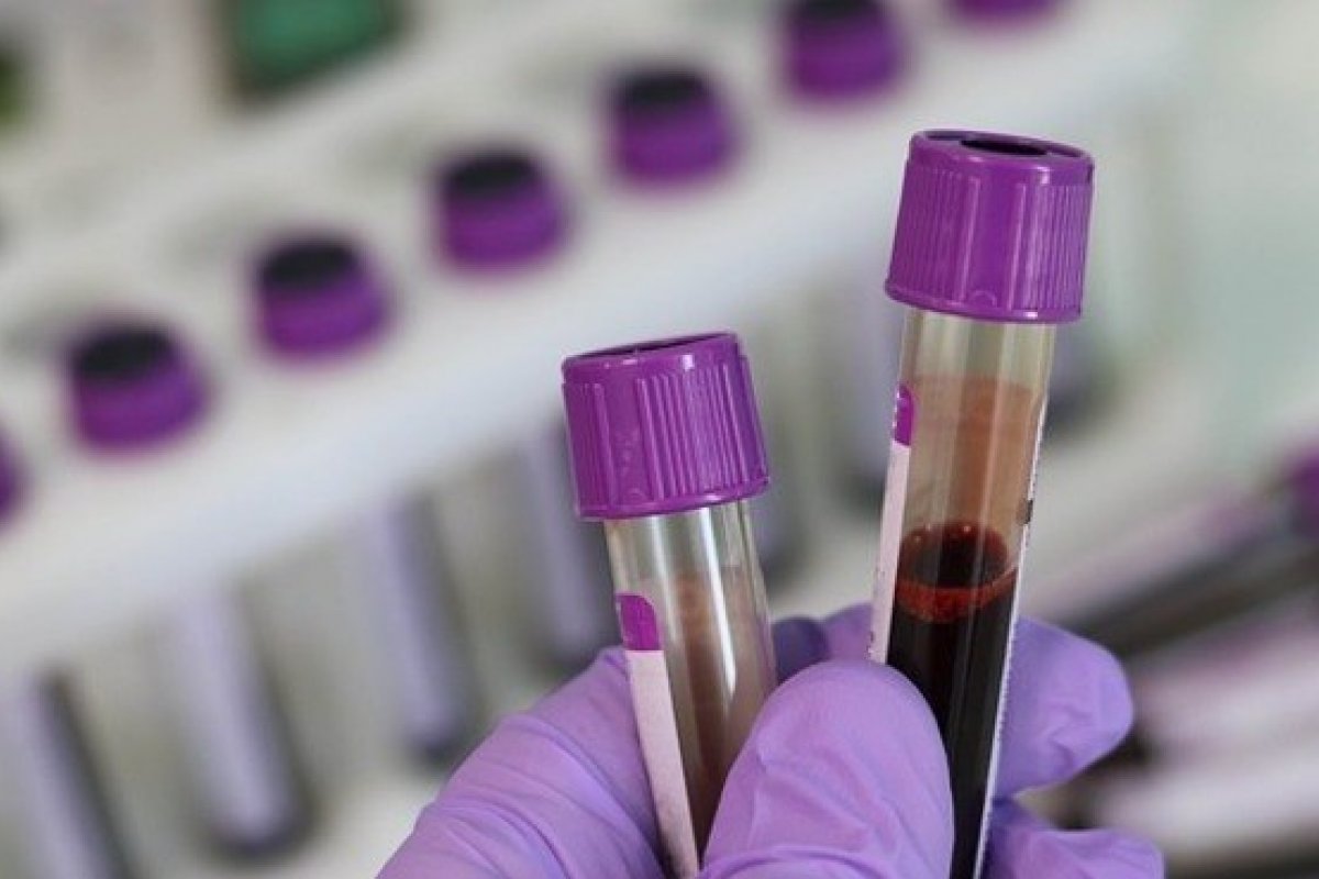 Doenças que atingem o fígado crescem durante a pandemia 