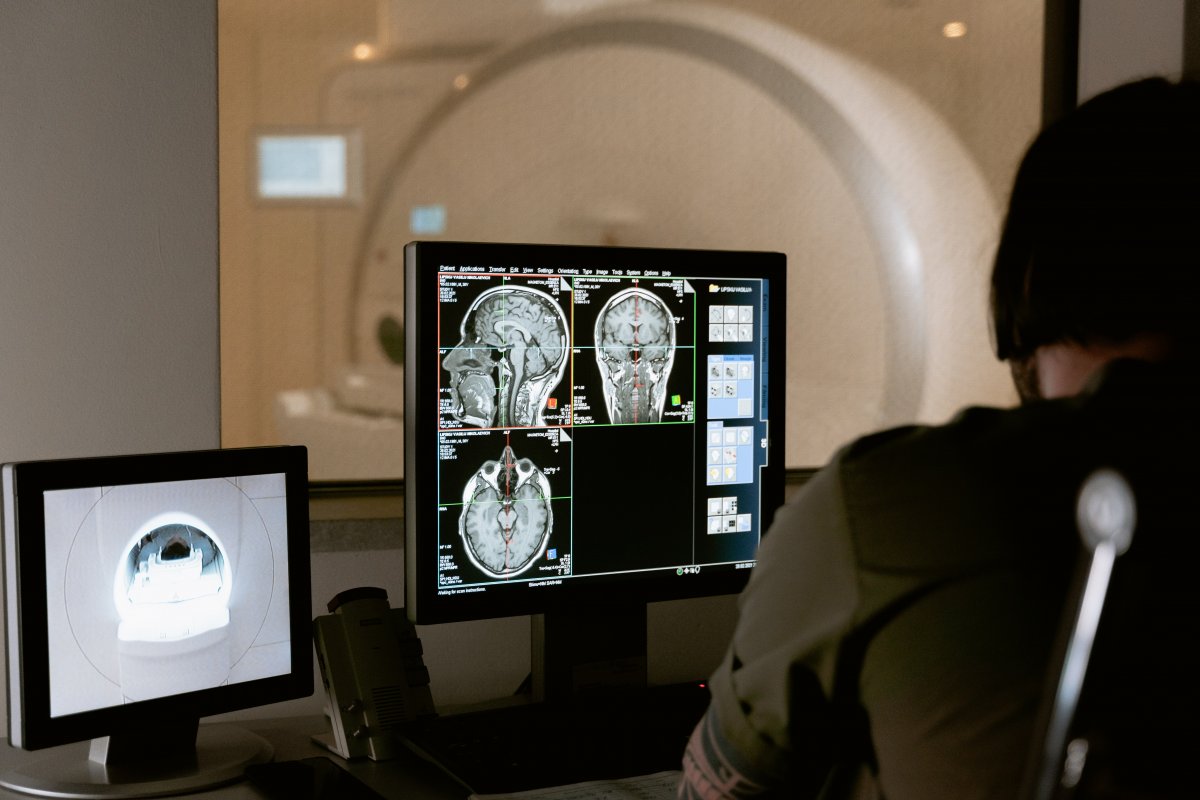 Perda de apetite após derrame, abre nova porta para desvendar o mecanismo cerebral que regula a fome