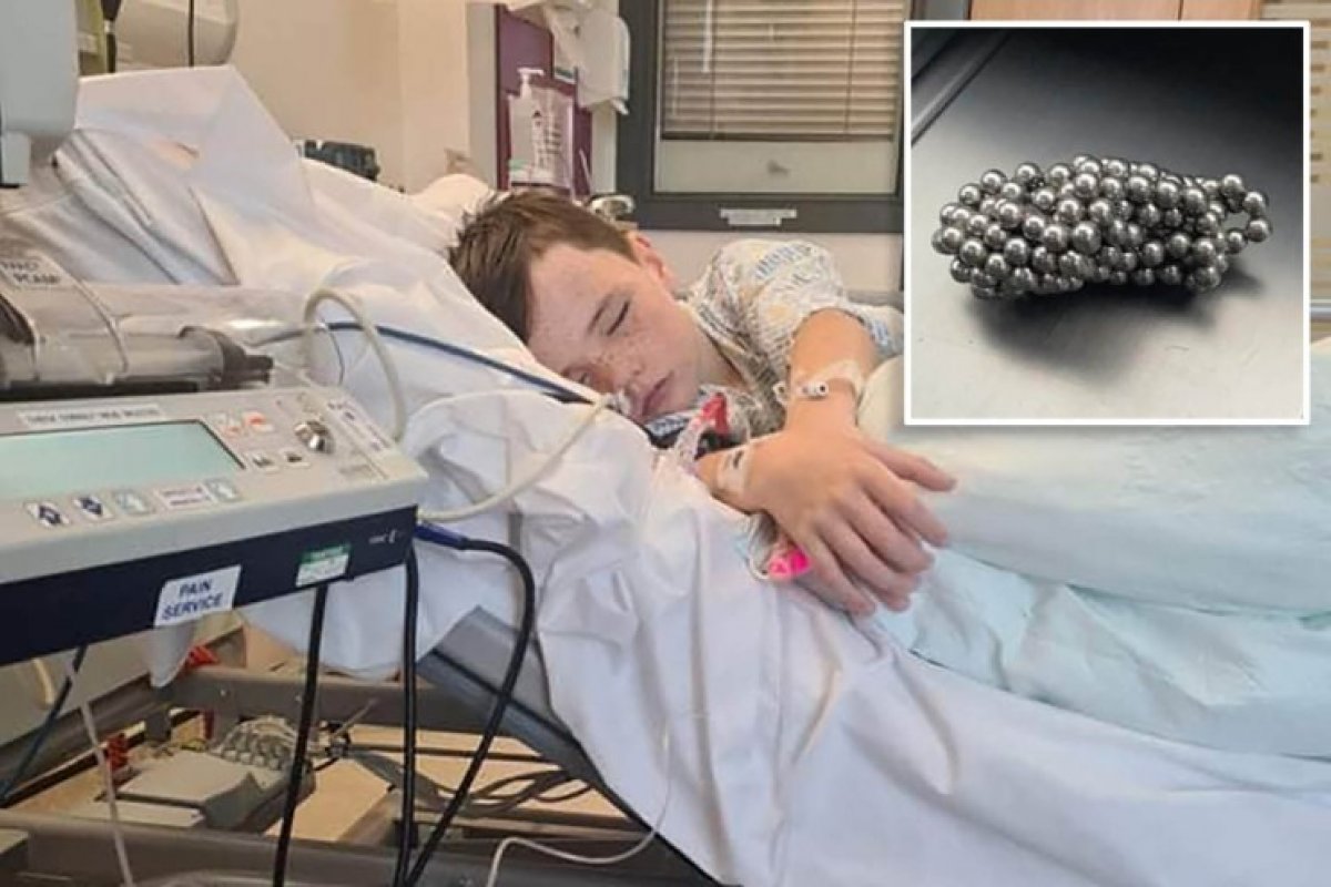 Criança é submetida a cirurgia após engolir ímãs para desafio viral no TikTok