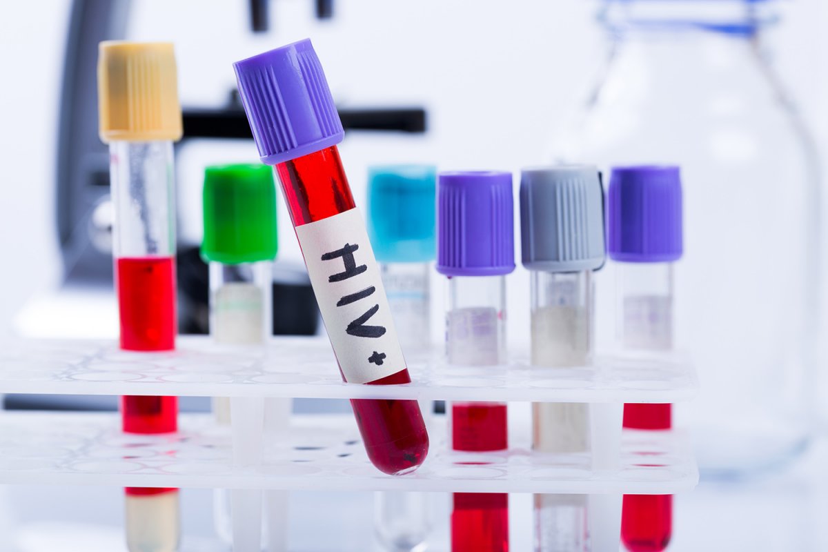 Casos positivos de HIV no Brasil registraram queda de 25% em 2020