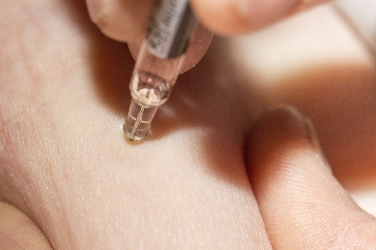 Anvisa proíbe propaganda de produtos com gestrinona 