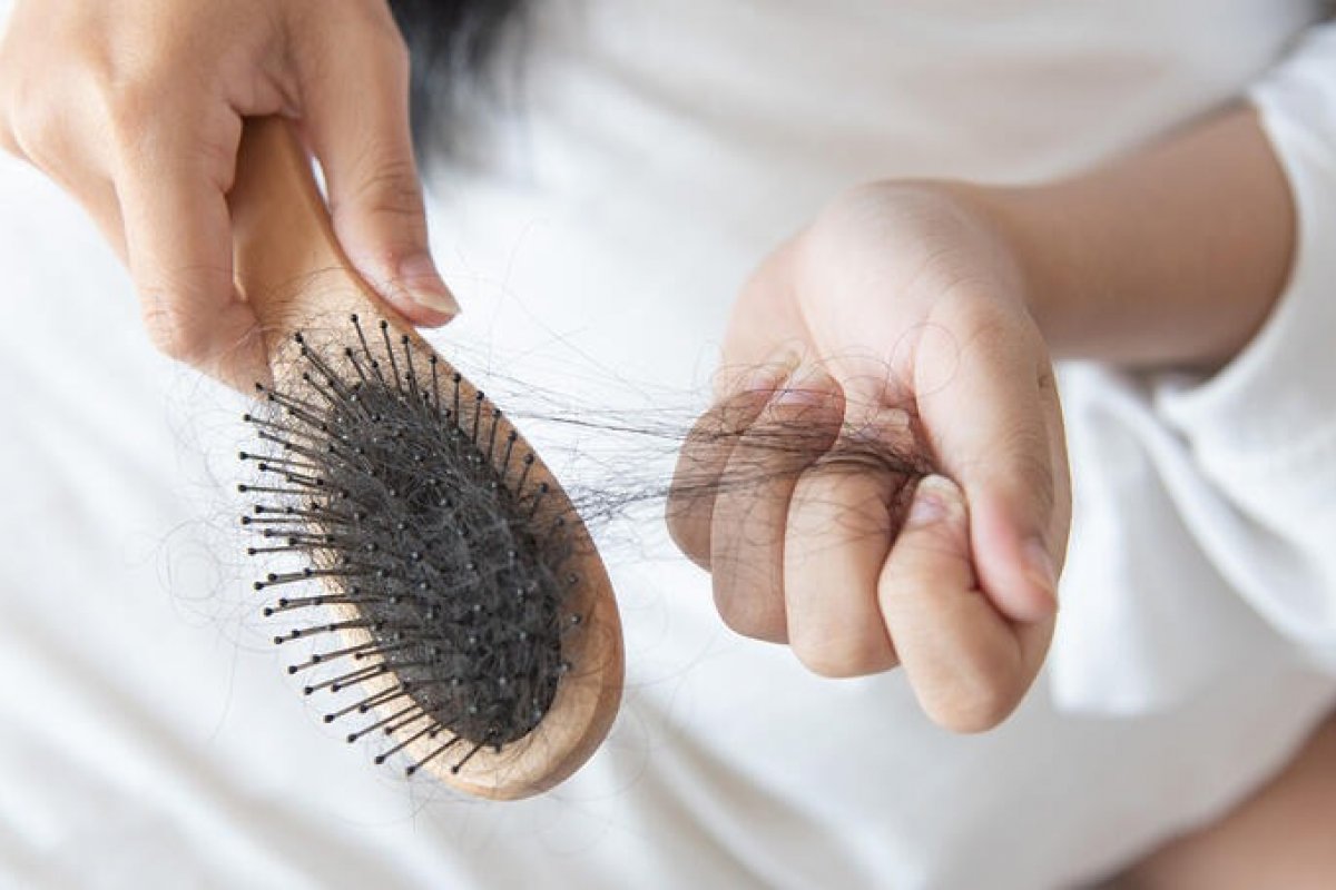 [Covid-19 pode causar queda de cabelo meses após contaminação, diz especialista]