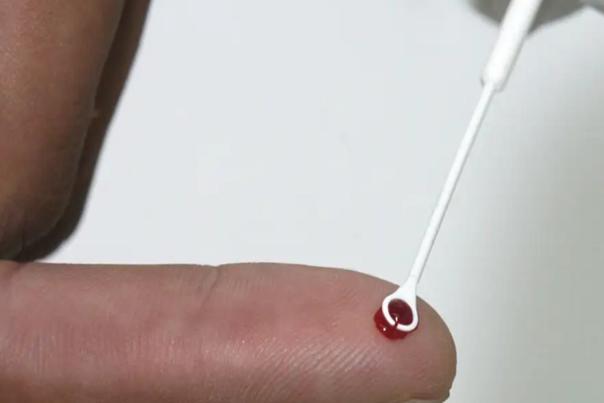 [Bahia apresenta redução nos números de Aids em 2023, aponta Sesab]