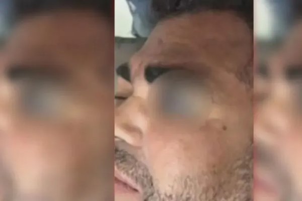 [Guardas municipais são suspeitos de agredir homem com pedaço de madeira na Bahia]