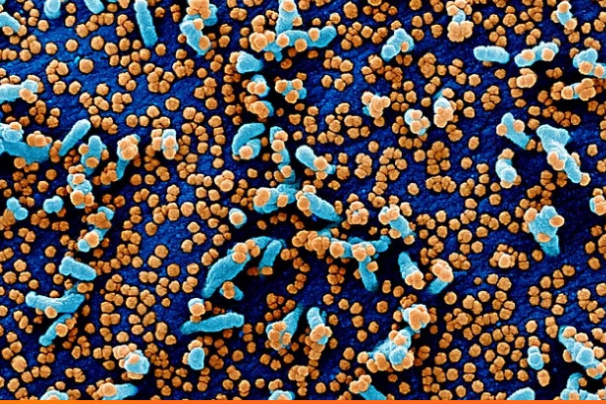[Instituto americano mostra imagens do coronavírus “matando” célula humana]