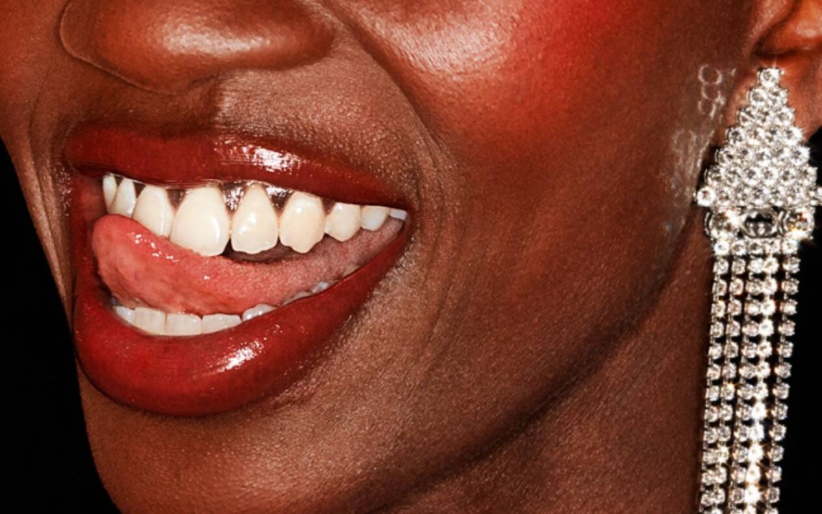 [Os dentes imperfeitos são a nova tendência de beleza]